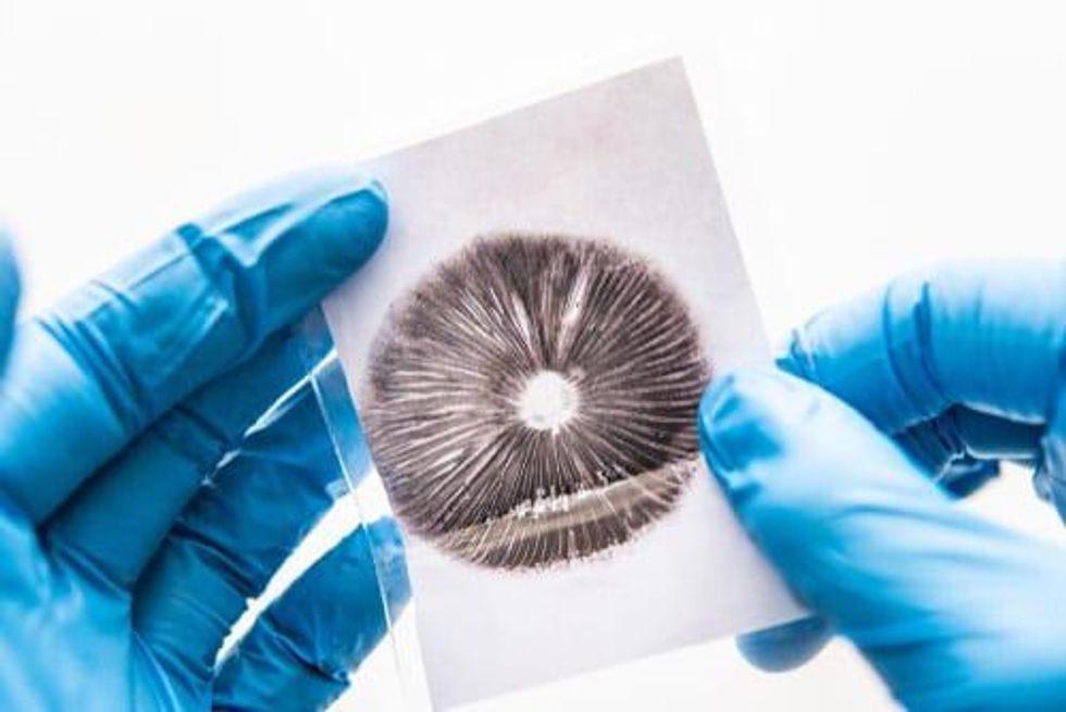 Oral Film Delivery Could Aid Psychedelic Drug Studies