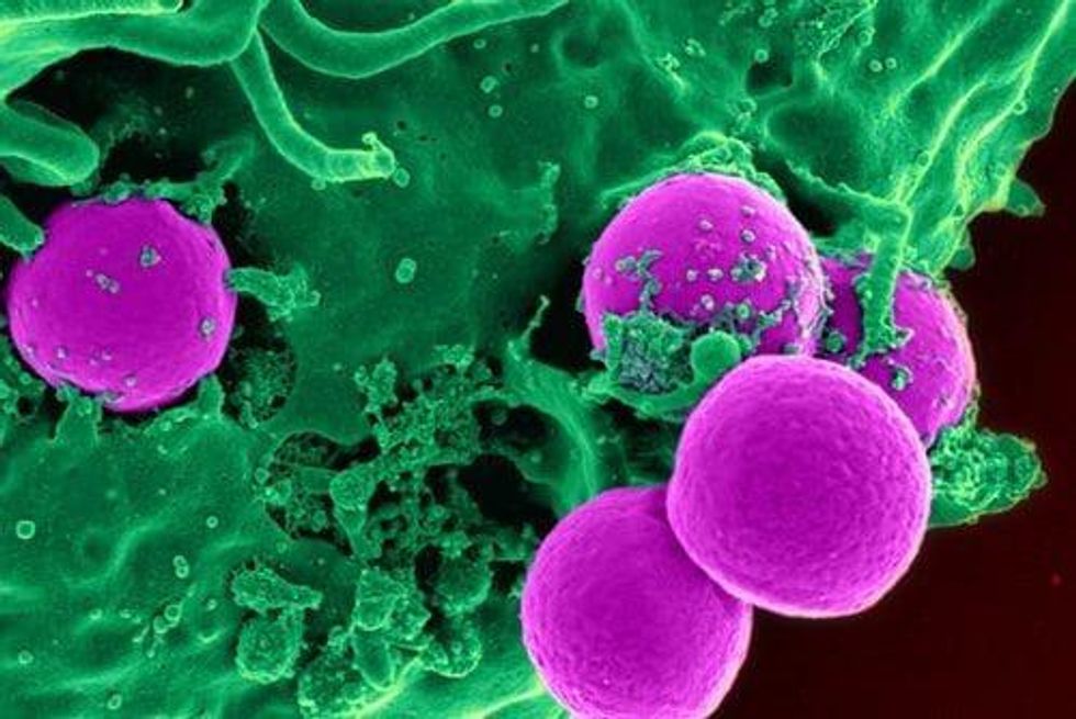 This is the Year for NurOwn’s Stem Cell Phase 3 ALS Development