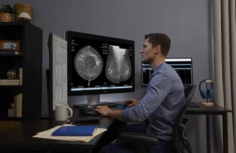 Hologic's AI-Powered Mammography Technology