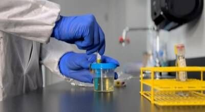 The BD Vacutainer® Urine Complete Cup Kit preserves specimen quality, streamlines testing, and helps reduce repeat collections to support better patient care.