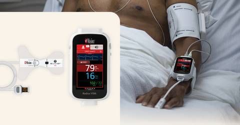 Opioid-Induced Respiratory Depression Detection with Masimo smartSET™ and Radius VSM®