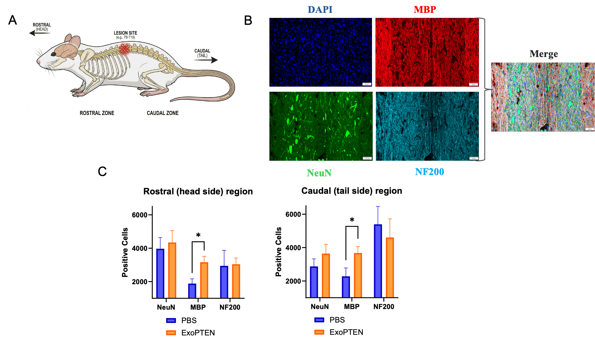 Figure 1: ExoPTEN-Treated Spinal Cord Tissue Shows Higher Numbers of MBP-Positive Cells Compared with Controls