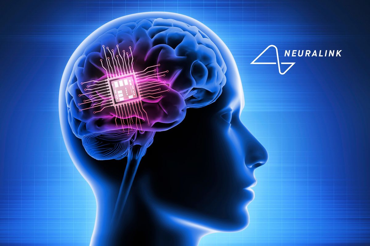 Mockup of a person with a brain chip like the one Neuralink is creating.