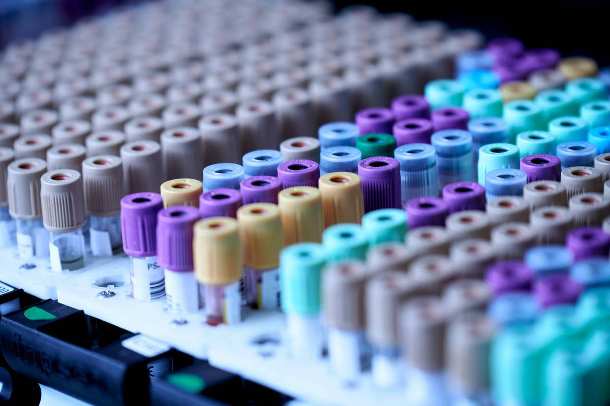 Rows of multicolored test tubes with brown, purple, blue and green caps arranged neatly on a white rack.