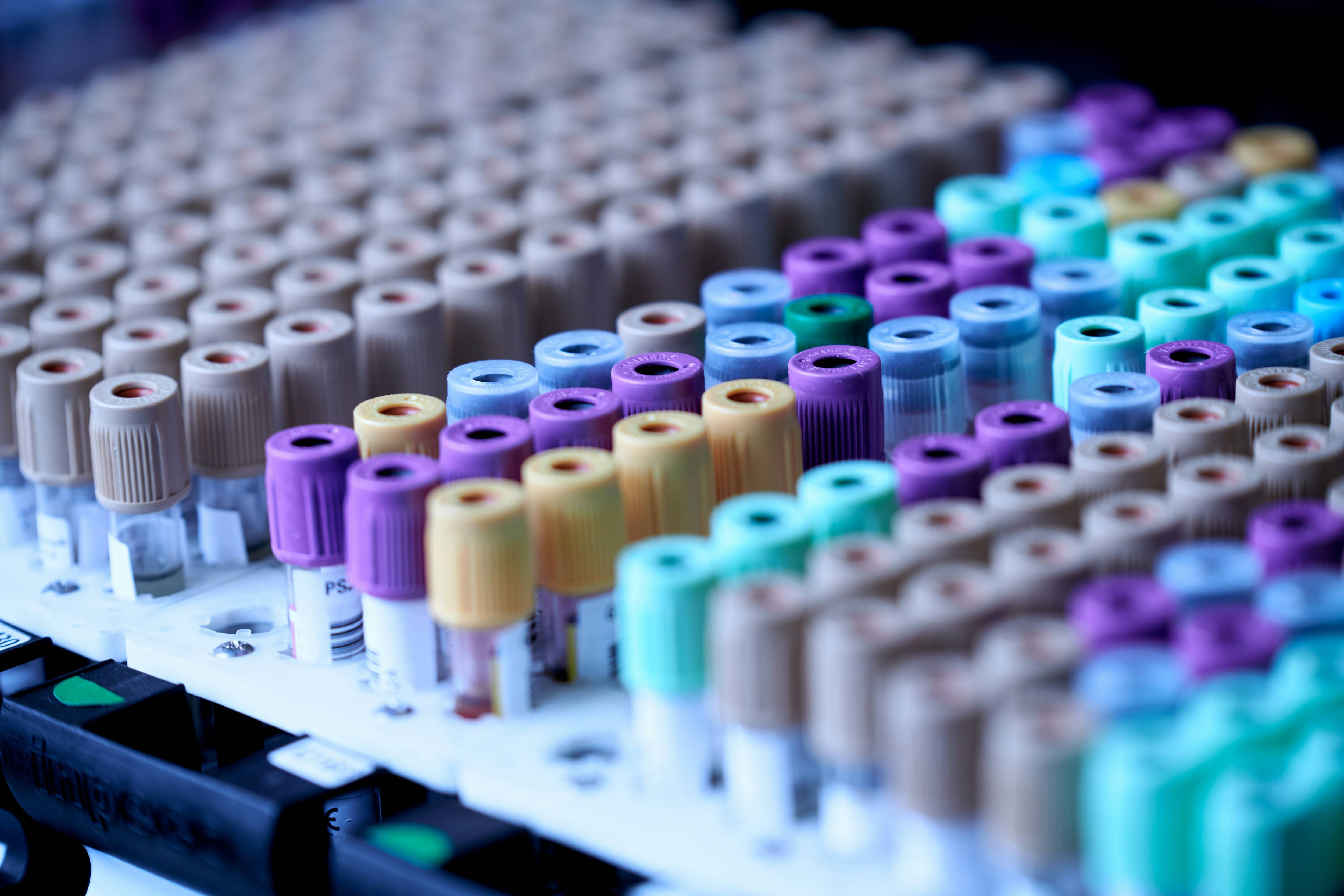 Rows of multicolored test tubes with brown, purple, blue and green caps arranged neatly on a white rack.