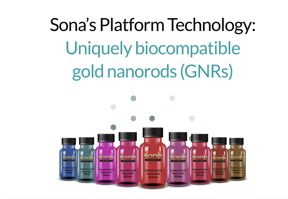 Sona's Platform Technology